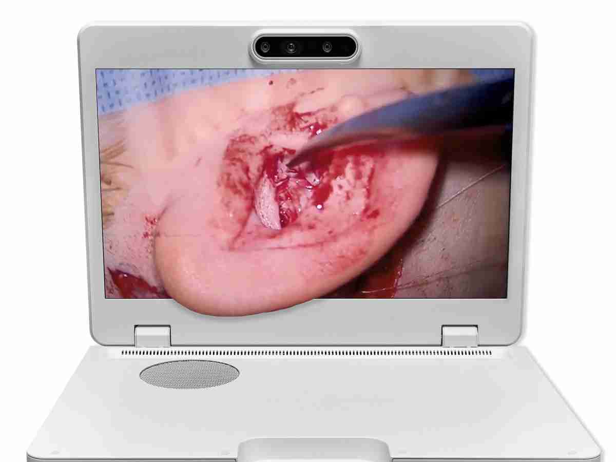 达擎之＂Heads-up 3D显微手术显示系统＂，，，整合4K裸眼3D显示及眼球追踪系统，，具备快速追踪人眼移动位置功能，，，，减轻医师长时间维持固定姿势的负担，，，，让医师能有更宽广清晰的3D立体视野及更舒适的姿势来执行手术。。。